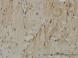TTN / Titin Antibody - Immunoperoxidase of monoclonal antibody to TTN on formalin-fixed paraffin-embedded human skeletal muscle. [antibody concentration 1 ug/ml]