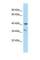 TTPA Antibody - TTPA antibody Western blot of Jurkat Cell lysate. Antibody concentration 1 ug/ml.  This image was taken for the unconjugated form of this product. Other forms have not been tested.