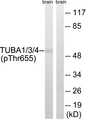 TUBA1+3+4 Antibody - Western blot analysis of lysates from Rat brain, using TUBA1/3/4 (Phospho-Tyr272) Antibody. The lane on the right is blocked with the phospho peptide.