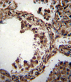 TUBA1C / Tubulin Alpha 1C Antibody - TUBA1C Antibody immunohistochemistry of formalin-fixed and paraffin-embedded human lung tissue followed by peroxidase-conjugated secondary antibody and DAB staining.