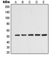 Antibody - Western blot analysis of Alpha-tubulin 3C/D/E expression in K562 (A); Jurkat (B); HeLa (C); HepG2 (D); NIH3T3 (E) whole cell lysates.