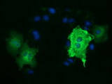 TUBA3E / Tubulin Alpha 3E Antibody - Anti-TUBA3E mouse monoclonal antibody  immunofluorescent staining of COS7 cells transiently transfected by pCMV6-ENTRY TUBA3E.