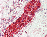 TUBB3 / Tubulin Beta 3 Antibody - Human Prostate, Nerve: Formalin-Fixed, Paraffin-Embedded (FFPE).  This image was taken for the unconjugated form of this product. Other forms have not been tested.