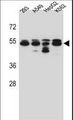 TUBB8 / Tubulin Beta 8 Antibody - TUBB8 Antibody western blot of 293,A549,HepG2,K562 cell line lysates (35 ug/lane). The TUBB8 antibody detected the TUBB8 protein (arrow).