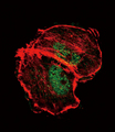 Tuberin / TSC2 Antibody - Confocal immunofluorescence of Phospho-TSC2-pS664 Antibody with MCF-7 cell followed by Alexa Fluor 488-conjugated goat anti-rabbit lgG (green). Actin filaments have been labeled with Alexa Fluor 555 phalloidin (red).