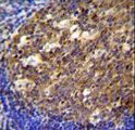 TWF2 / PTK9L Antibody - PTK9L Antibody immunohistochemistry of formalin-fixed and paraffin-embedded human tonsil tissue followed by peroxidase-conjugated secondary antibody and DAB staining.
