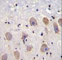 TWIK1 / KCNK1 Antibody - KCNK1 Antibody immunohistochemistry of formalin-fixed and paraffin-embedded human brain tissue followed by peroxidase-conjugated secondary antibody and DAB staining.
