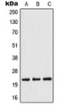 TWIST1 / TWIST Antibody - Western blot analysis of TWIST expression in Jurkat (A); Raw264.7 (B); rat liver (C) whole cell lysates.