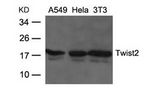 TWIST2 Antibody - Western blot of extracts from A549, HeLa and 3T3 cells using Twist2 Antibody