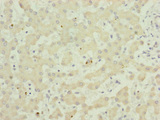 TWIST2 Antibody - Immunohistochemistry of paraffin-embedded human liver tissue at dilution of 1:100