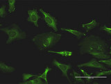 TXK / RLK Antibody - Immunofluorescence of monoclonal antibody to TXK on HeLa cell . [antibody concentration 20 ug/ml]