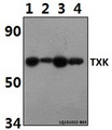 TXK / RLK Antibody - Western blot of TXK antibody at 1:500 dilution. Lane 1: Jurkat whole cell lysate (40 ug). Lane 2: The Spleen tissue lysate of Rat(30 ug). Lane 3: The Spleen tissue lysate of Mouse(30 ug). Lane 4: THP-1 whole cell lysate (40 ug).
