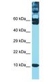 TXN / Thioredoxin / TRX Antibody - TXN / Thioredoxin / TRX antibody Western Blot of MCF7. Antibody dilution: 1 ug/ml.  This image was taken for the unconjugated form of this product. Other forms have not been tested.