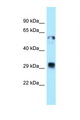 TXNDC1 / TMX1 Antibody - TMX1 / TXNDC antibody Western blot of Fetal Lung lysate. Antibody concentration 1 ug/ml.  This image was taken for the unconjugated form of this product. Other forms have not been tested.