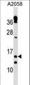 TXNRD3NB Antibody - TXNRD3IT1 Antibody western blot of A2058 cell line lysates (35 ug/lane). The TXNRD3IT1 antibody detected the TXNRD3IT1 protein (arrow).