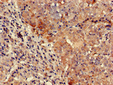 TYK2 Antibody - Immunohistochemistry of paraffin-embedded human adrenal gland tissue at dilution of 1:100