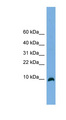 TYMSOS Antibody - C18orf56 antibody Western blot of Fetal Brain lysate. This image was taken for the unconjugated form of this product. Other forms have not been tested.