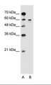 Tyrosinase Antibody - A: Marker, B: Jurkat Cell Lysate.  This image was taken for the unconjugated form of this product. Other forms have not been tested.