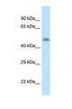 Tyrosine Aminotransferase Antibody - TAT / Tyrosine Aminotransferase antibody Western blot of Rat Brain lysate. Antibody concentration 1 ug/ml.  This image was taken for the unconjugated form of this product. Other forms have not been tested.