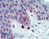 TYRP1 / gp75 Antibody - Anti-TYRP1 /gp75 antibody IHC of human skin. Immunohistochemistry of formalin-fixed, paraffin-embedded tissue after heat-induced antigen retrieval. Antibody concentration 5 ug/ml.  This image was taken for the unconjugated form of this product. Other forms have not been tested.