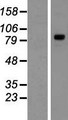 TYW1 Protein - Western validation with an anti-DDK antibody * L: Control HEK293 lysate R: Over-expression lysate