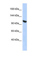 UBA1 / UBE1 Antibody - UBA1 / UBE1 antibody Western blot of HepG2 cell lysate. This image was taken for the unconjugated form of this product. Other forms have not been tested.