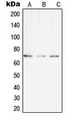 UBASH3A / CLIP4 Antibody - Western blot analysis of CLIP4 expression in THP1 (A); SP2/0 (B); H9C2 (C) whole cell lysates.