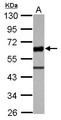 UBASH3A / CLIP4 Antibody - Sample (30 ug of whole cell lysate) A: THP-1 10% SDS PAGE UBASH3A antibody diluted at 1:2000