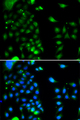 UBC6 / UBE2J2 Antibody - Immunohistochemistry of paraffin-embedded rat liver tissue.