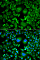 UBCH / UBE2H Antibody - Immunofluorescence analysis of A549 cells.