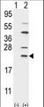 UBCH10 / UBE2C Antibody - Western blot of UBE2C (arrow) using rabbit polyclonal UBE2C Antibody (N-term G25). 293 cell lysates (2 ug/lane) either nontransfected (Lane 1) or transiently transfected with the UBE2C gene (Lane 2) (Origene Technologies). (8 ug/ml)