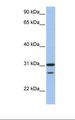 UBCH10 / UBE2C Antibody - Fetal muscle lysate. Antibody concentration: 1.0 ug/ml. Gel concentration: 12%.  This image was taken for the unconjugated form of this product. Other forms have not been tested.