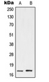 Antibody - Western blot analysis of UBE2A/B expression in HeLa (A); Jurkat (B) whole cell lysates.