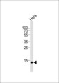 UBE2D2 / UBCH5B Antibody - Western blot of lysate from HeLa cell line, using UBE2D2 Antibody. Antibody was diluted at 1:1000 at each lane. A goat anti-rabbit IgG H&L (HRP) at 1:5000 dilution was used as the secondary antibody. Lysate at 35ug per lane.