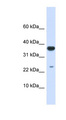 UBE2D2 / UBCH5B Antibody - UBE2D2 antibody Western blot of Fetal Liver lysate. This image was taken for the unconjugated form of this product. Other forms have not been tested.