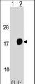 UBE2D3 / UBCH5C Antibody - Western blot of UBE2D3 (arrow) using rabbit polyclonal UBE2D3 Antibody. 293 cell lysates (2 ug/lane) either nontransfected (Lane 1) or transiently transfected (Lane 2) with the UBE2D3 gene.