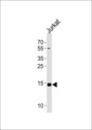 UBE2D4 Antibody - Western blot of lysate from Jurkat cell line, using UBE2D4 Antibody. Antibody was diluted at 1:1000 at each lane. A goat anti-rabbit IgG H&L (HRP) at 1:5000 dilution was used as the secondary antibody. Lysate at 35ug per lane.