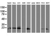 UBE2E3 Antibody - Western blot of extracts (35 ug) from 9 different cell lines by using anti-UBE2E3 monoclonal antibody (HepG2: human; HeLa: human; SVT2: mouse; A549: human; COS7: monkey; Jurkat: human; MDCK: canine; PC12: rat; MCF7: human).