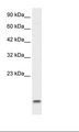 UBE2N / UBC13 Antibody - HepG2 Cell Lysate.  This image was taken for the unconjugated form of this product. Other forms have not been tested.