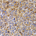 UBE2R2 Antibody - Immunohistochemistry of paraffin-embedded mouse cancer tissue.