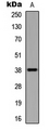 UBE2U Antibody - Western blot analysis of UBE2U expression in HEK293T (A) whole cell lysates.