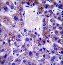 UBE2W Antibody - UBE2W Antibody immunohistochemistry of formalin-fixed and paraffin-embedded human liver tissue followed by peroxidase-conjugated secondary antibody and DAB staining.
