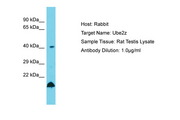 UBE2Z / USE1 Antibody -  This image was taken for the unconjugated form of this product. Other forms have not been tested.