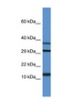 UBL3 Antibody - UBL3 antibody Western blot of Rat Kidney lysate. Antibody concentration 1 ug/ml. This image was taken for the unconjugated form of this product. Other forms have not been tested.