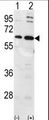 UBQLN1 / Ubiquilin Antibody - Western blot of Ubiquilin1 (arrow) using Ubiquilin1 Antibody. 293 cell lysates (2 ug/lane) either nontransfected (Lane 1) or transiently transfected with the Ubiquilin1 gene (Lane 2) (Origene Technologies).