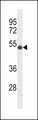 UBR7 / C14orf130 Antibody - UBR7 Antibody western blot of MDA-MB231 cell line lysates (35 ug/lane). The UBR7 antibody detected the UBR7 protein (arrow).