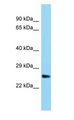 UBTD1 Antibody - UBTD1 antibody Western Blot of Rat Muscle.  This image was taken for the unconjugated form of this product. Other forms have not been tested.