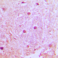 UBTD1 Antibody - Immunohistochemical analysis of UBTD1 staining in human brain formalin fixed paraffin embedded tissue section. The section was pre-treated using heat mediated antigen retrieval with sodium citrate buffer (pH 6.0). The section was then incubated with the antibody at room temperature and detected using an HRP conjugated compact polymer system. DAB was used as the chromogen. The section was then counterstained with hematoxylin and mounted with DPX.