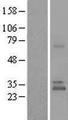 UBTD1 Protein - Western validation with an anti-DDK antibody * L: Control HEK293 lysate R: Over-expression lysate