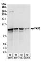 UBXD7 Antibody - Detection of human FXR2 by western blot. Samples: Whole cell lysate from HEK293T (15 and 50 µg), HeLa (50µg), and Jurkat (50µg) cells. Antibodies: Affinity purified rabbit anti-FXR2 antibody used for WB at 0.1 µg/ml. Detection: Chemiluminescence with an exposure time of 30 seconds.